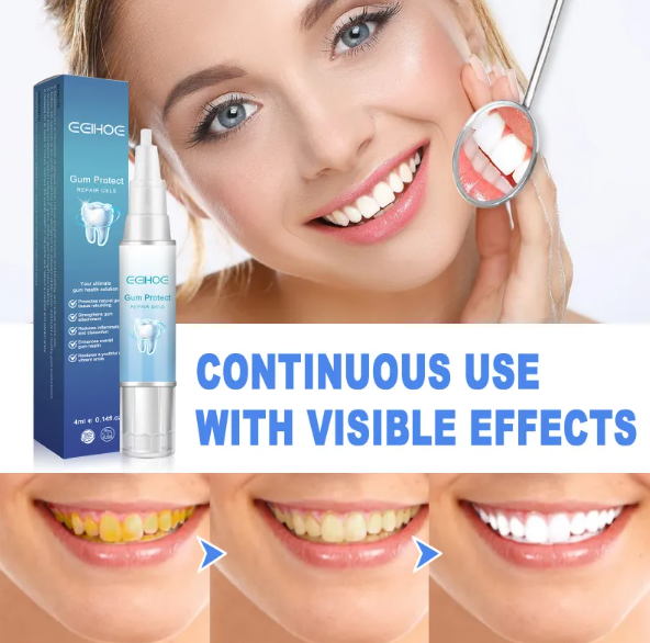 Teeth Repair Gel – Gum Relief & Oral Care with Hyaluronic Acid & Aloe