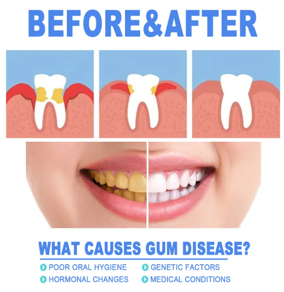Teeth Repair Gel – Gum Relief & Oral Care with Hyaluronic Acid & Aloe
