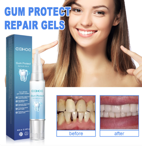 Teeth Repair Gel – Gum Relief & Oral Care with Hyaluronic Acid & Aloe